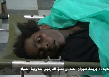 صور مؤلمة من الحديدة جراء ارتكاب التحالف جريمة بحق النازحين